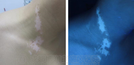 图片11.png